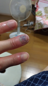 爪　再生への道
