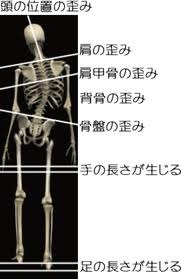 ネコと腰痛