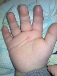 いろいろな病気・・・ 2011/06/05 21:46:05